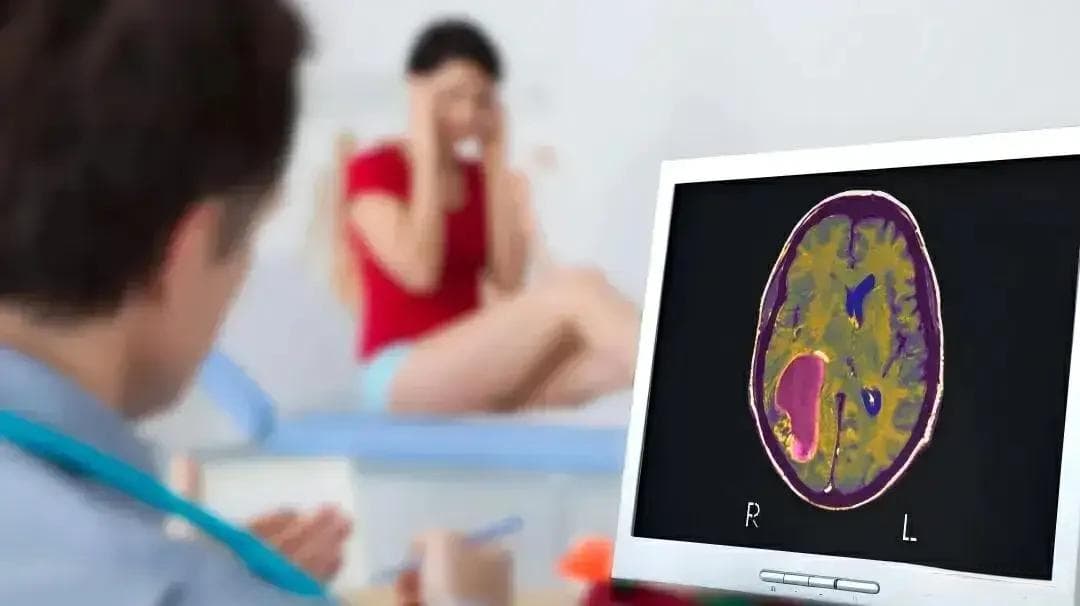 戴在头上的“紧箍咒”——偏头痛，除了吃止痛药，还能做些啥？