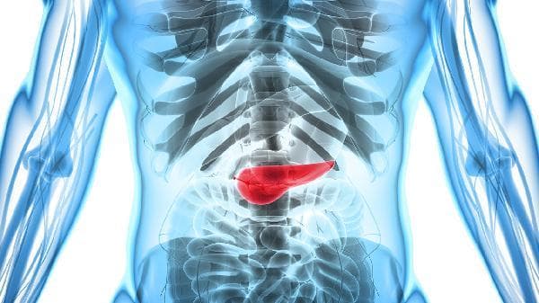 急性胰腺炎严重吗？从病因到治疗全解析