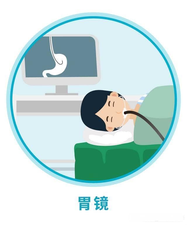 诊断胃食管反流病，这三项检查少不了！
