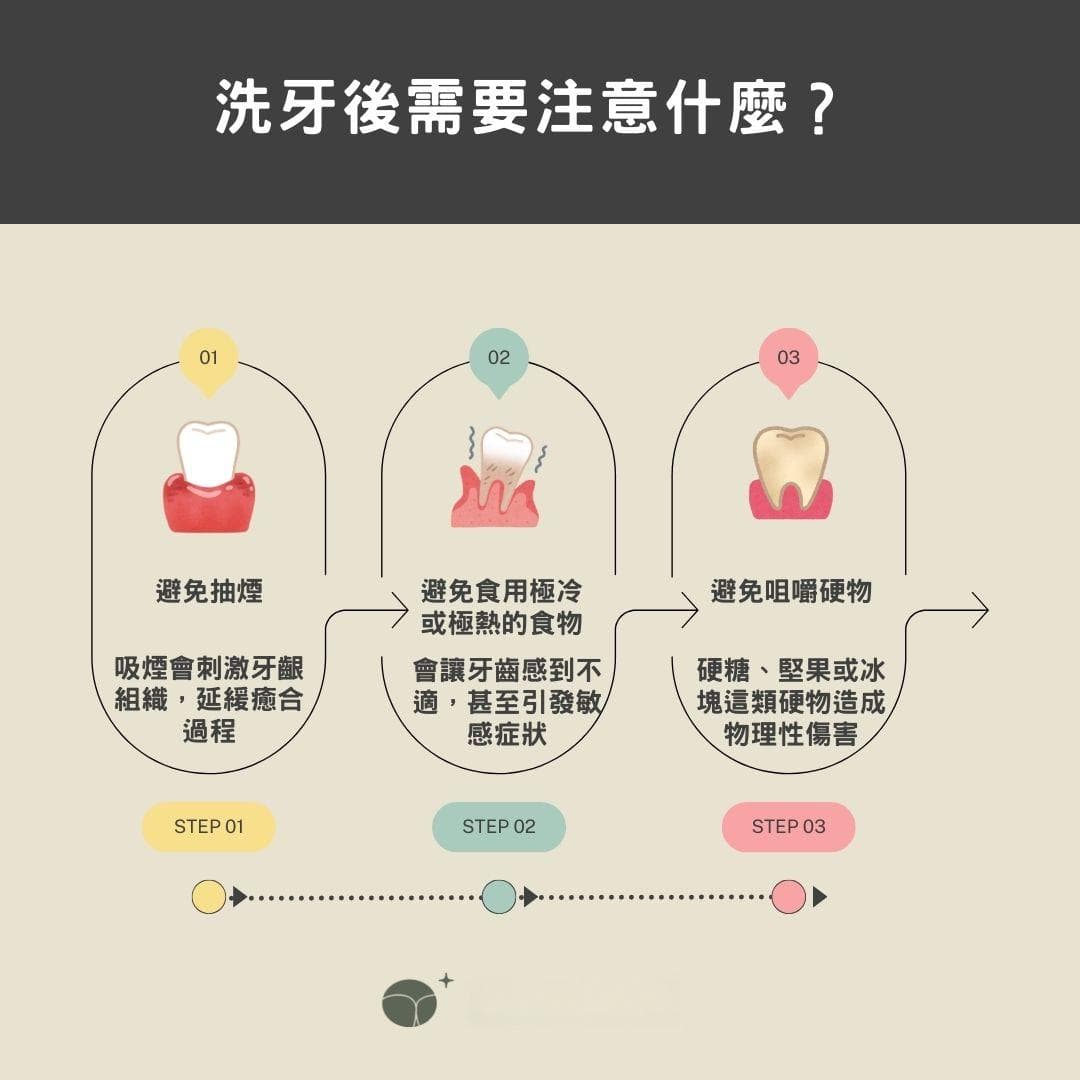 洗牙多久才完成？了解洗牙過程和所需時間