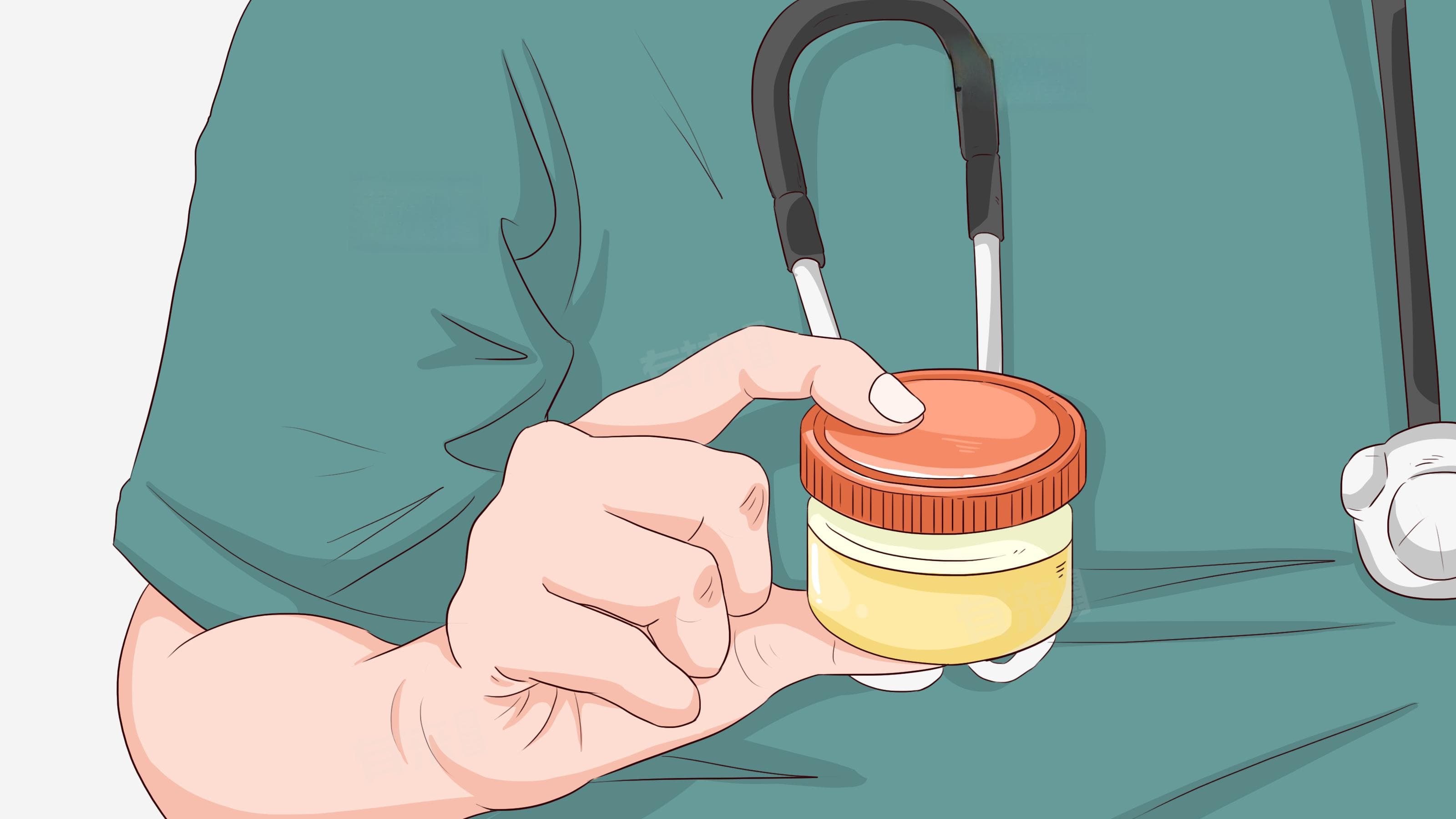 肌酐高怎么办？这份健康指南请收好