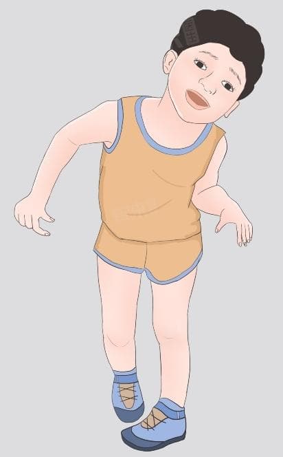 小孩踮脚尖走路是什么原因