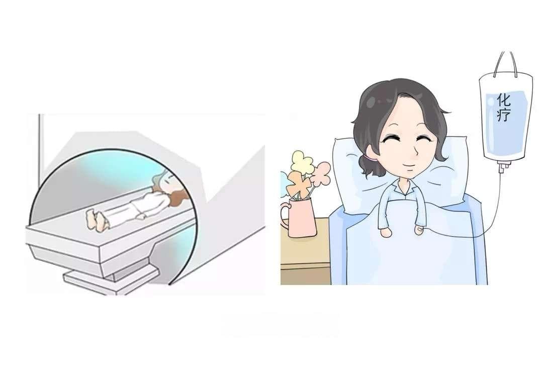 放疗和化疗哪个副作用小