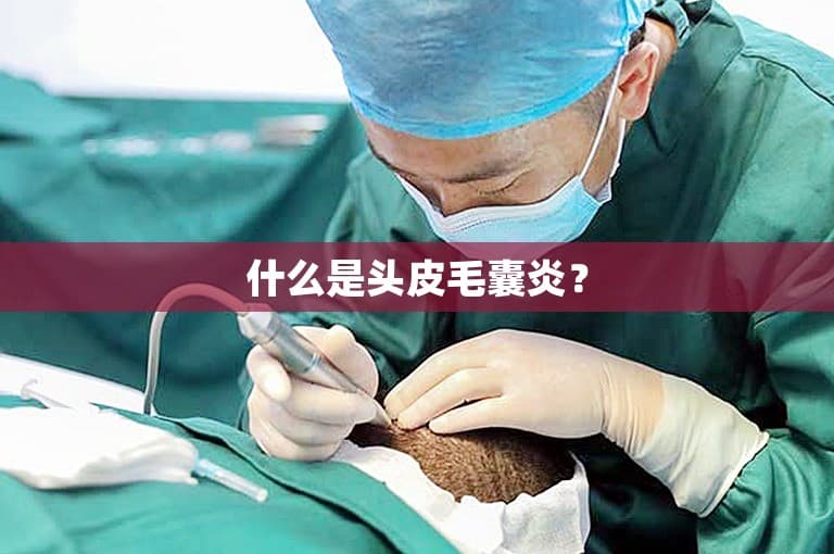 什么是头皮毛囊炎？