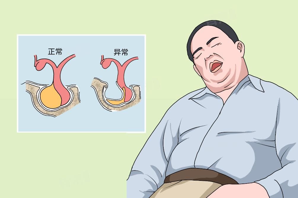 空泡蝶鞍的最佳治疗方法