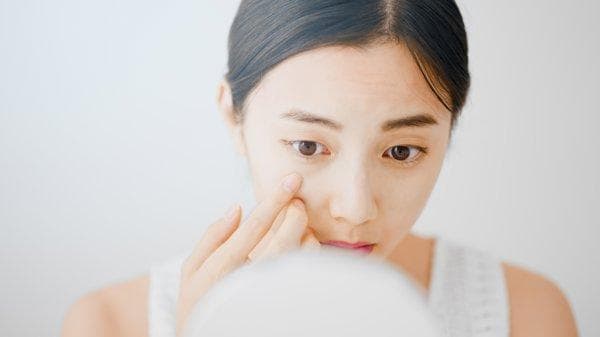 衰老型眼袋怎么形成的
