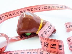 胰头癌引起的黄疸：发病机制、症状及治疗方案