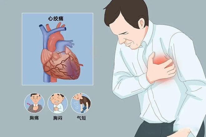 双和散治疗冠心病、心绞痛