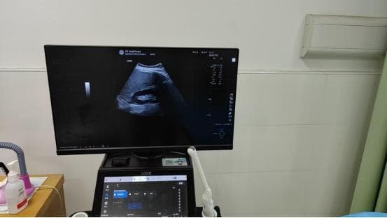 超声波在医学领域的应用及意义