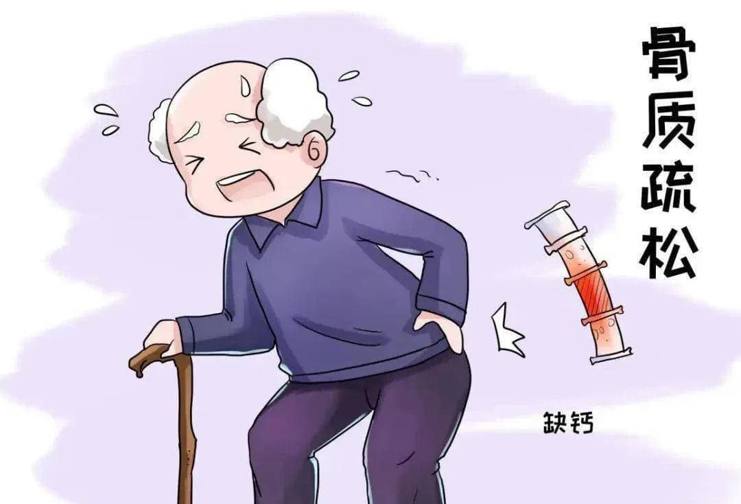 医生分析老年人为什么容易骨折，如何检测骨密度，如何预防骨折？