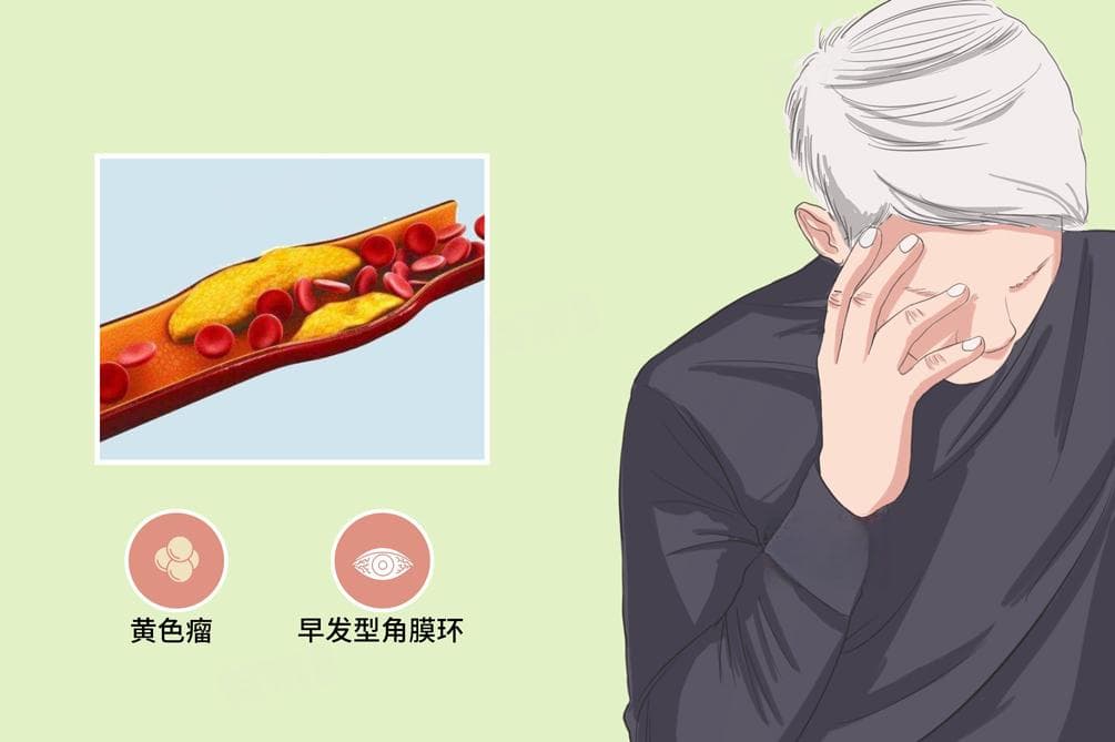 总胆固醇偏高怎么降下来