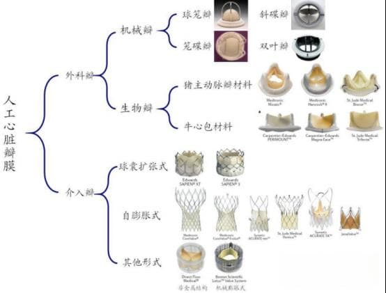 人工心脏瓣膜的分类及瓣膜特点