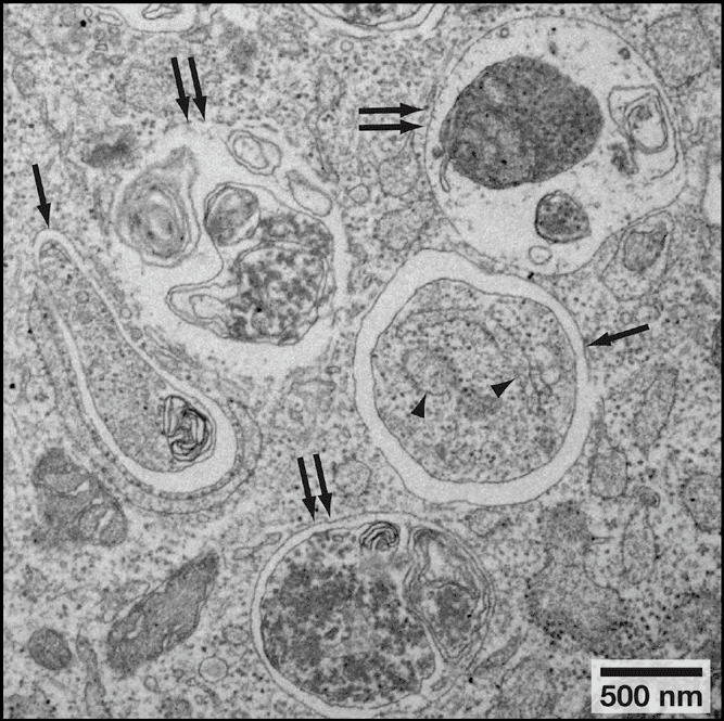 细胞自噬(Autophagy)