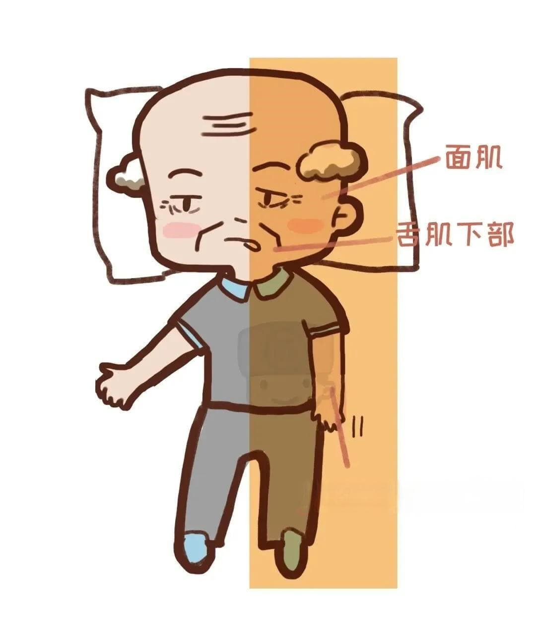 偏瘫的康复之路