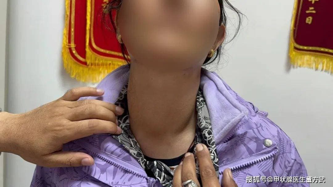甲状腺癌是如何转移的？让我们一起来看一下