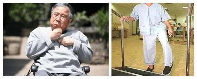 脑出血后偏瘫患者如何把握手术治疗时机？