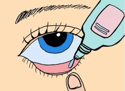 正确使用眼药水：7个步骤+7个注意事项全解析