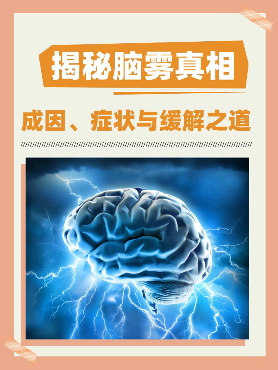 揭秘脑雾真相：成因、症状与缓解之道