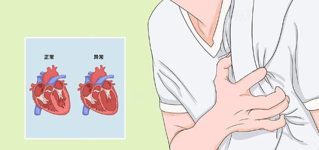 充血性心力衰竭的诊断标准及预防措施