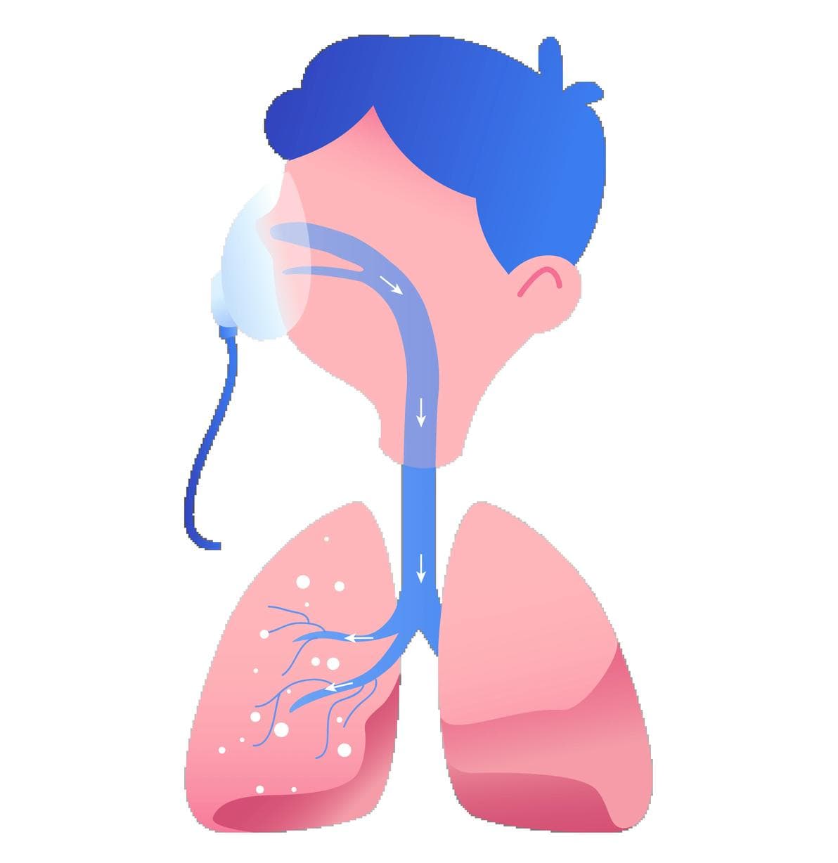 肺结节手术后如何正确运动与快速恢复