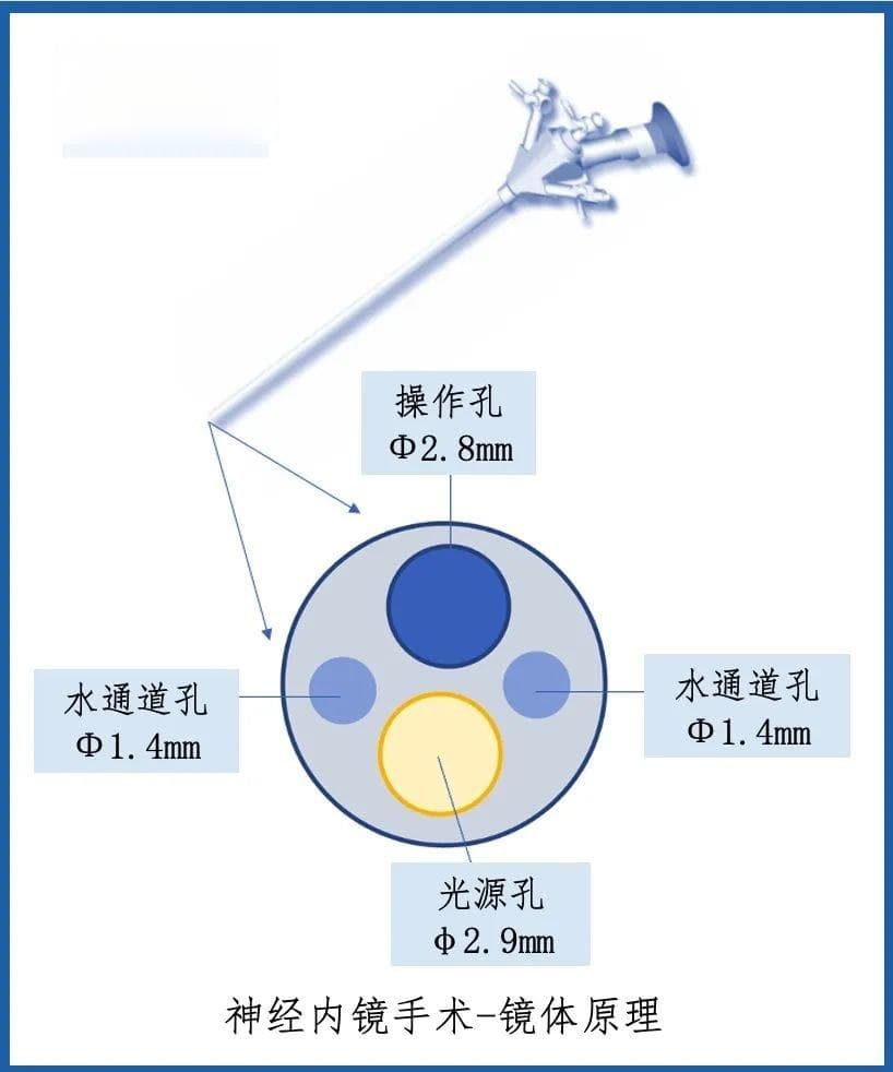 为何它不见刀口、却能切大瘤？“十八般”手术设备知多少？