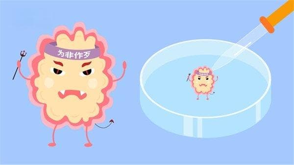 少突胶质细胞增生
