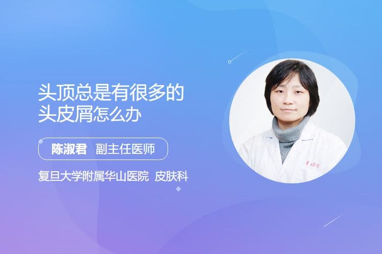 头顶总是有很多的头皮屑怎么办
