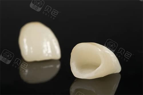 牙冠费用全解析：从材质到医院，影响牙冠价格的关键因素