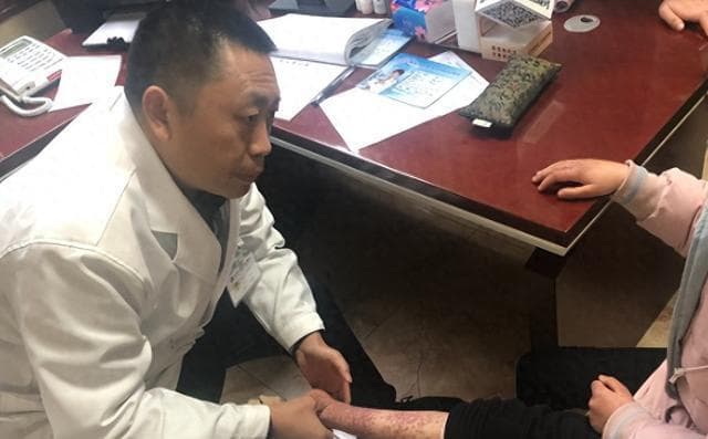 过敏性紫癜频繁复发？医生忠告：防治合一是治疗的关键！