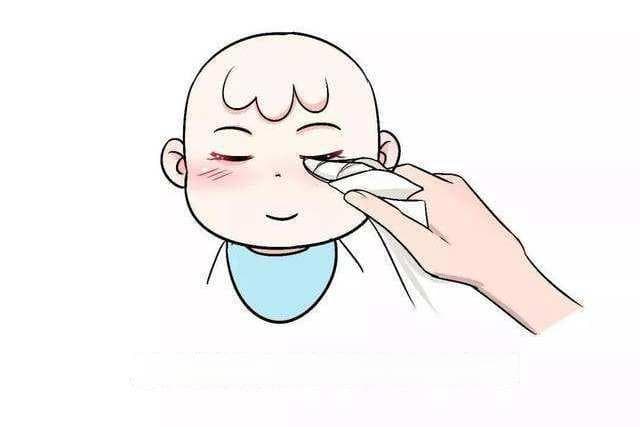 新生儿眼部护理指南