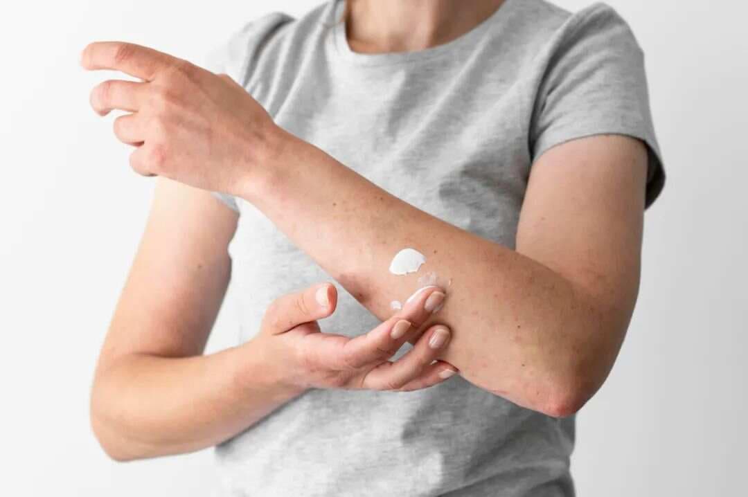 皮肤感染用药指南：莫匹罗星、夫西地酸与多粘菌素B软膏的异同与选用