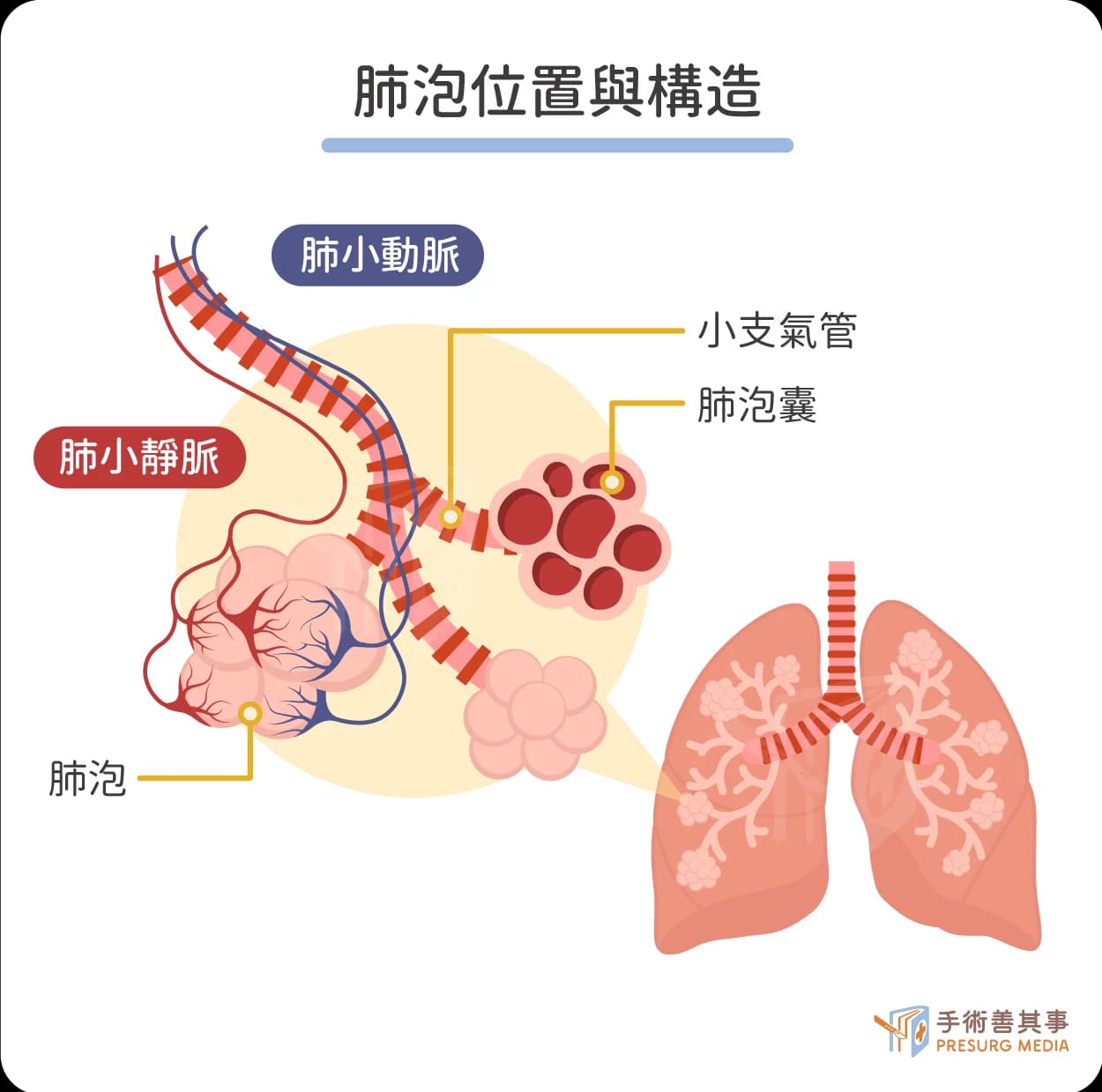 氣胸會自己好嗎？氣胸症狀、原因、治療、後遺症一次看