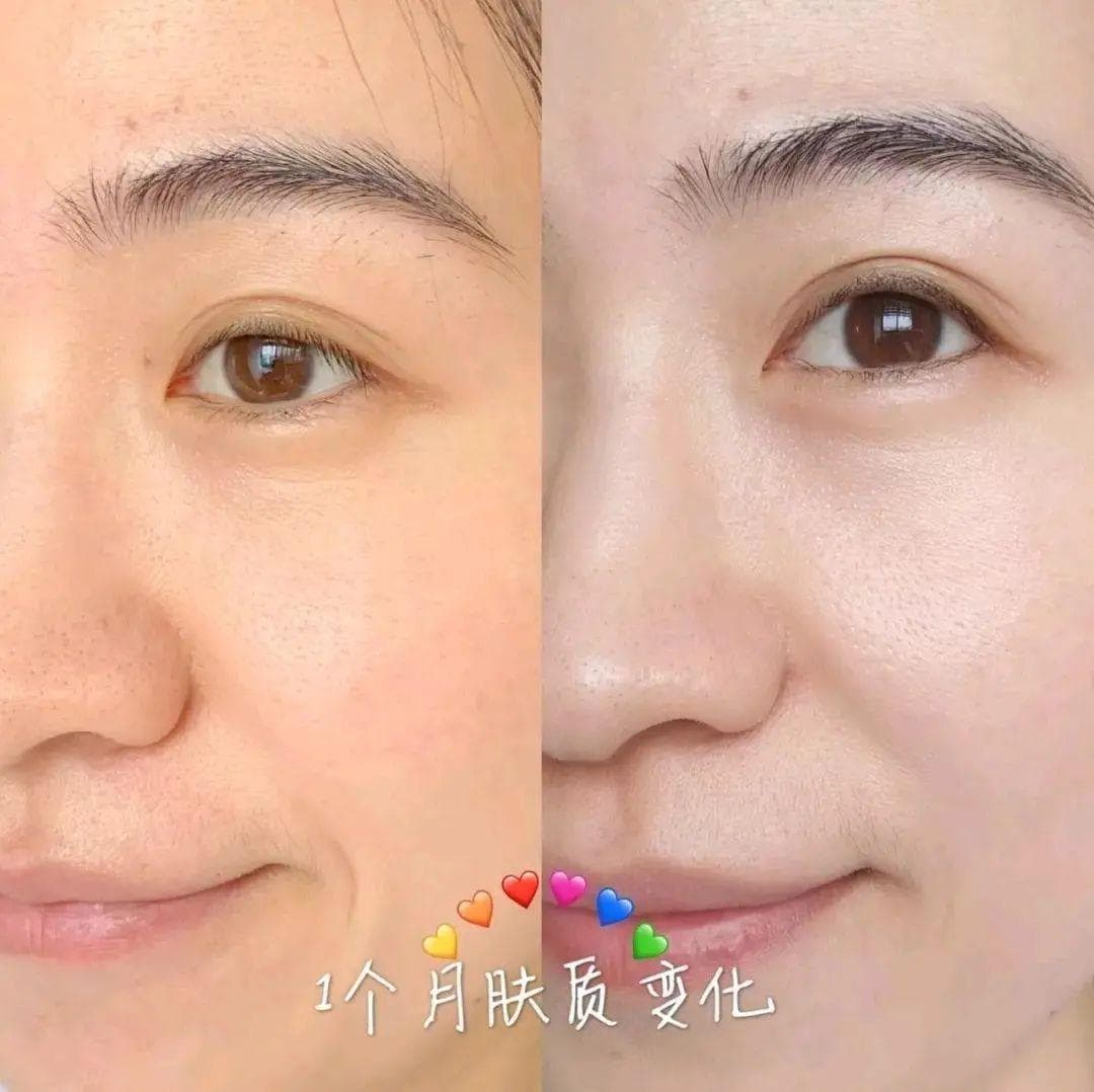拒绝烂脸！皮肤科医生教你正确刷酸