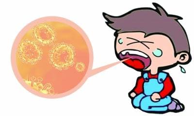 详解小儿疱疹性咽峡炎的治疗和预防