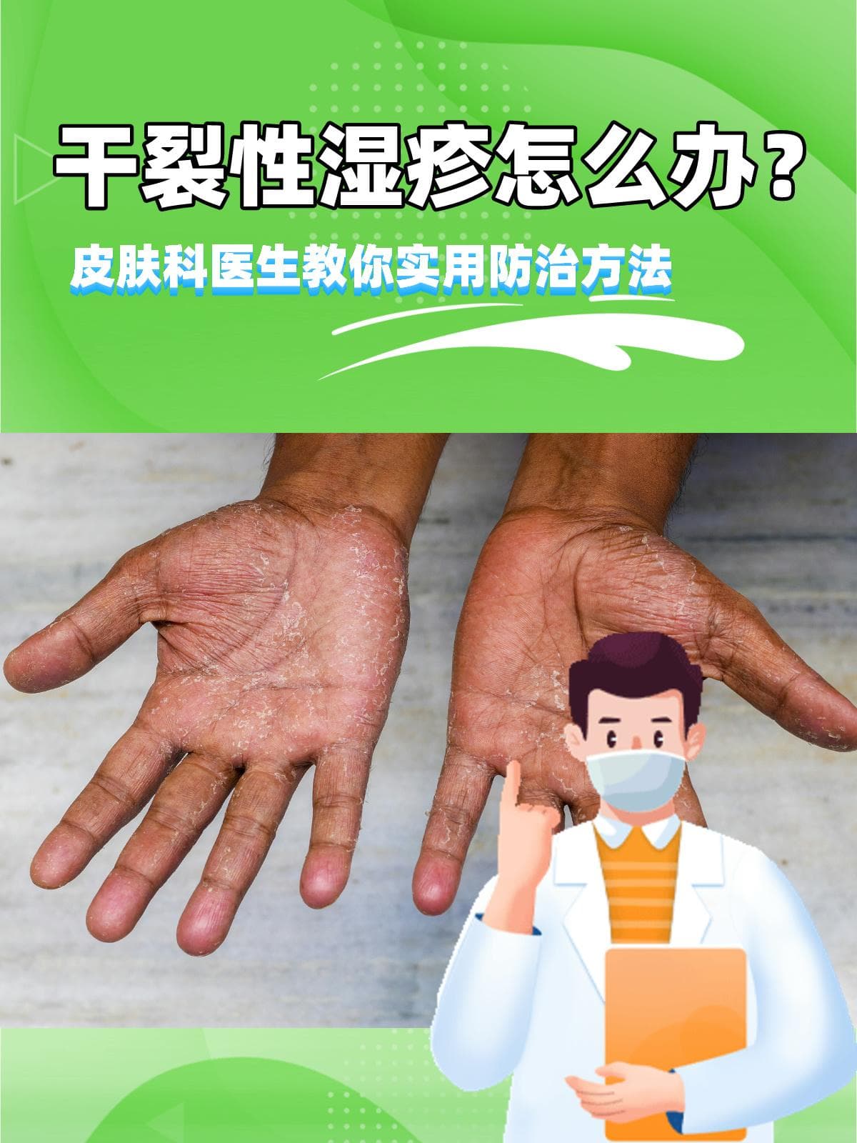 干裂性湿疹怎么办？皮肤科医生教你实用防治方法