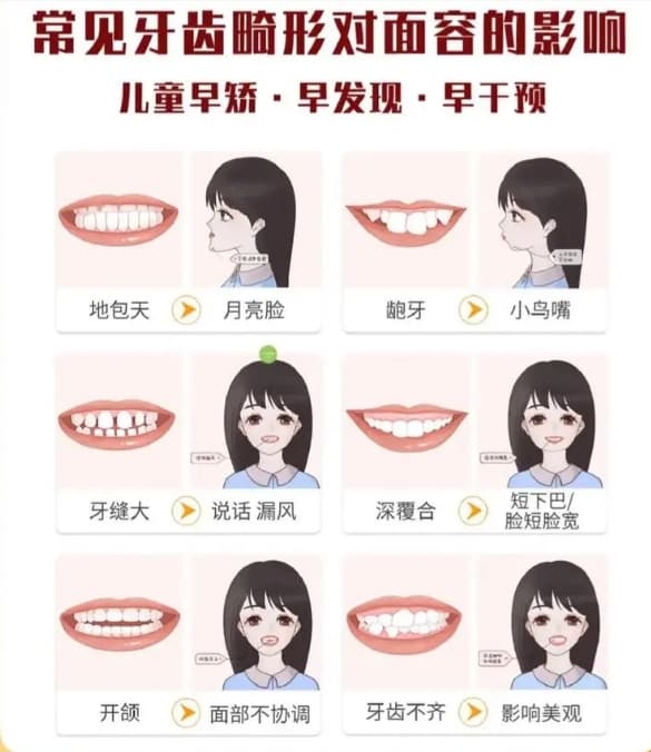 如何进行儿童牙齿早期干预？
