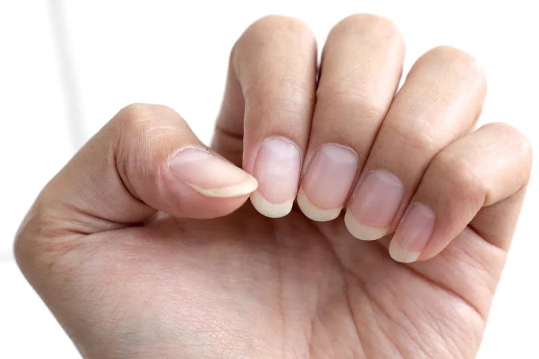 科学素质提升｜指甲月牙小、有竖纹，就是不健康？错！这些真相一定要知道