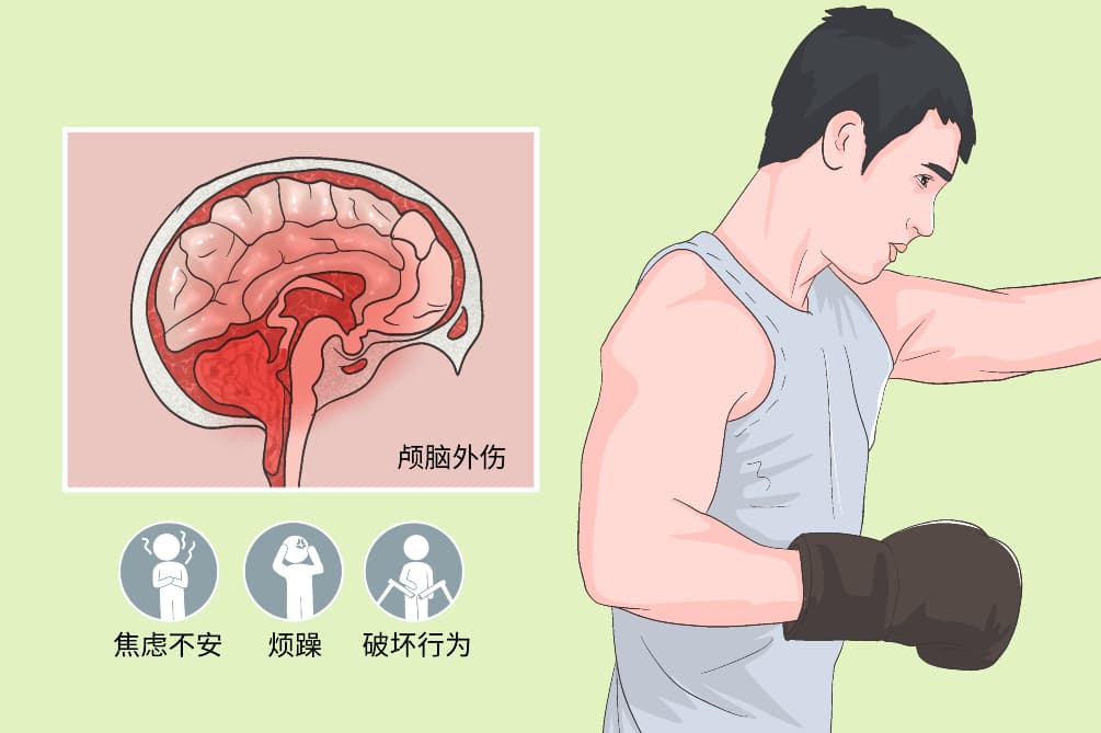攻击行为：医学领域的全面解析
