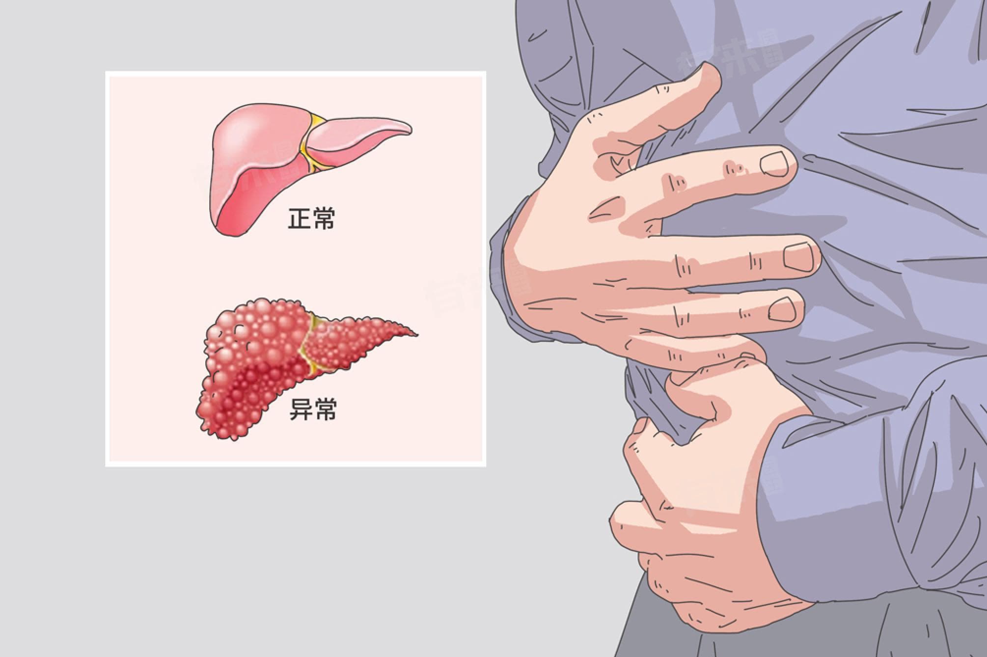腹水不抽能否把人胀死