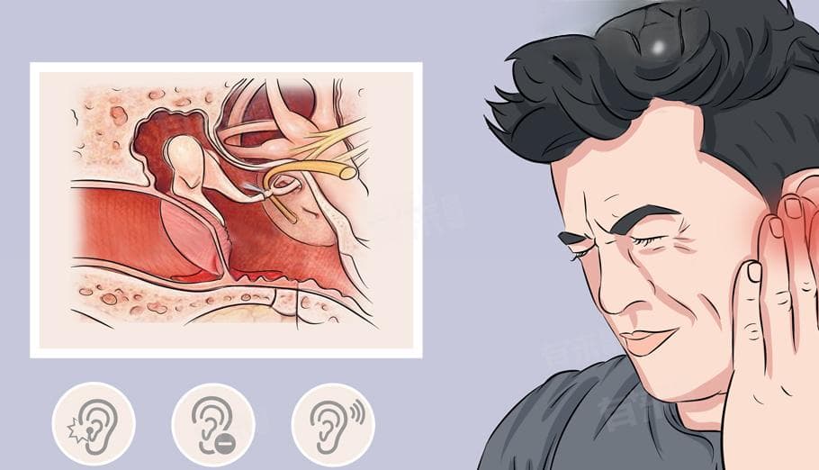 耳朵的鼓膜穿孔：病因、症状与治疗全解析