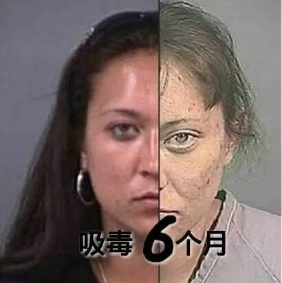 吸毒前后容貌对比让人震惊！这些"毁容日记"触目惊心