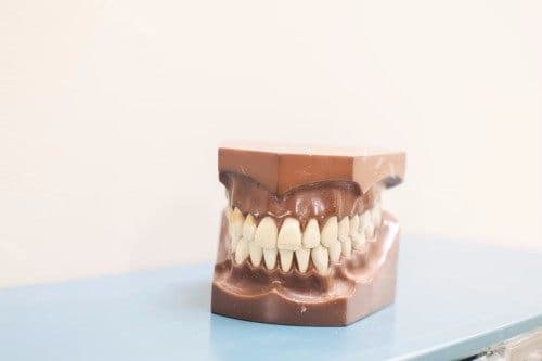MRC矫治器矫正口呼吸有用吗？具有显著结果！以下是详细介绍！