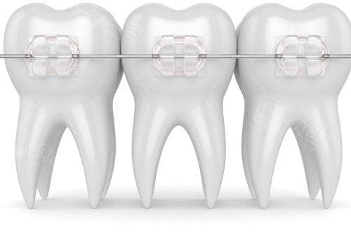 牙齿有缝隙怎么修复比较好？3种方式可以解决牙缝大