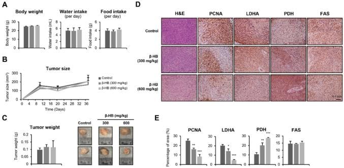 β-HB治疗通过改变糖酵解-乳酸代谢逆转肝癌索拉非尼耐药
