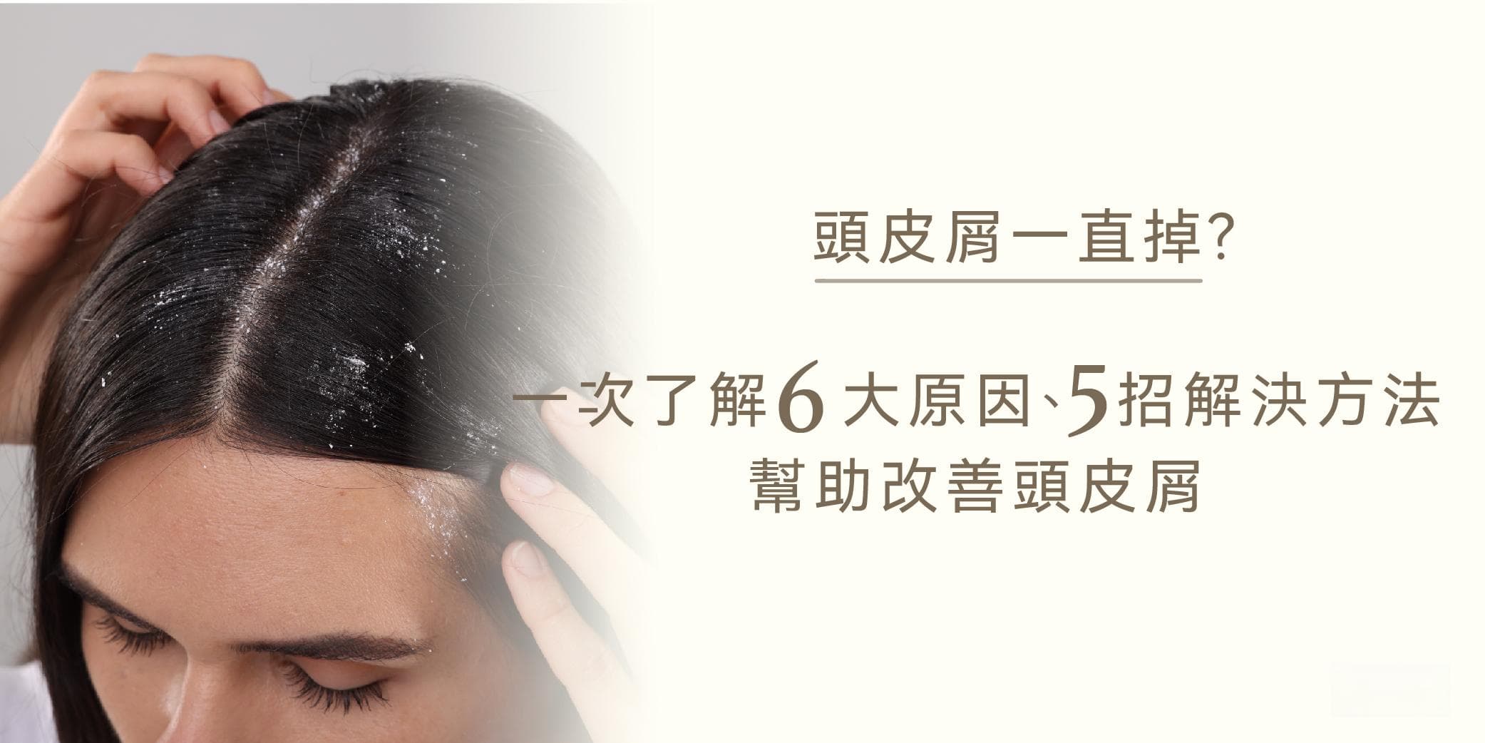 头皮屑一直掉？一次了解6大原因、5招解决方法，帮助改善头皮屑