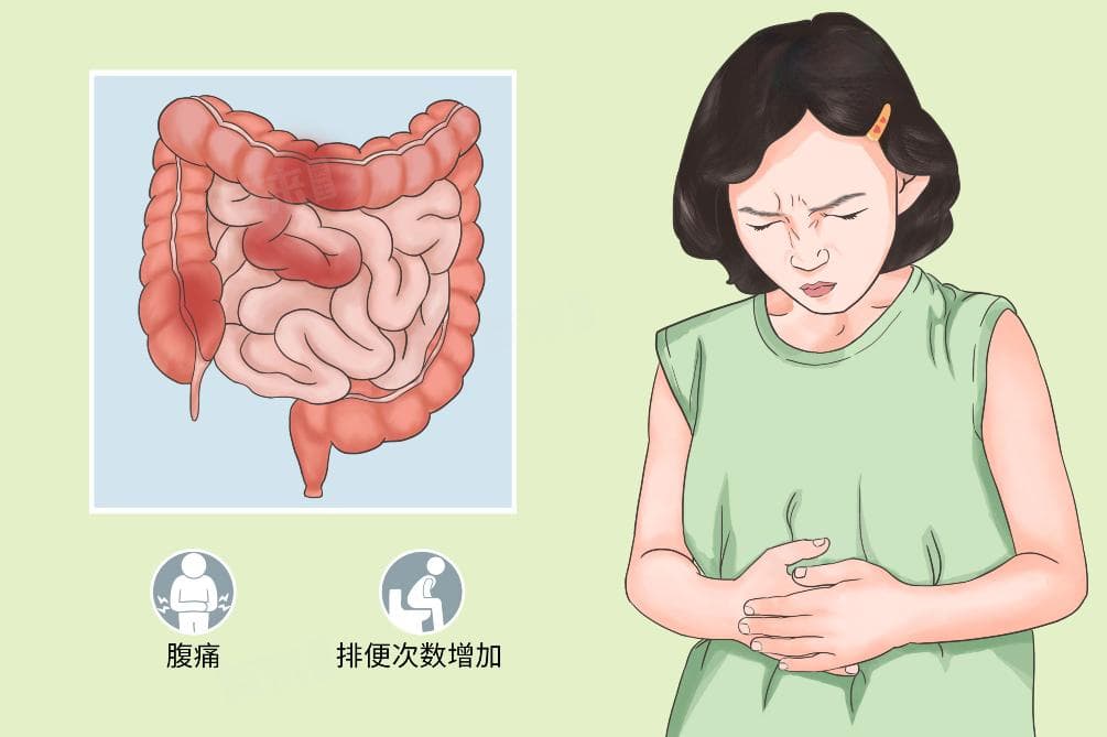 拉肚子几次算危险？这些症状需警惕