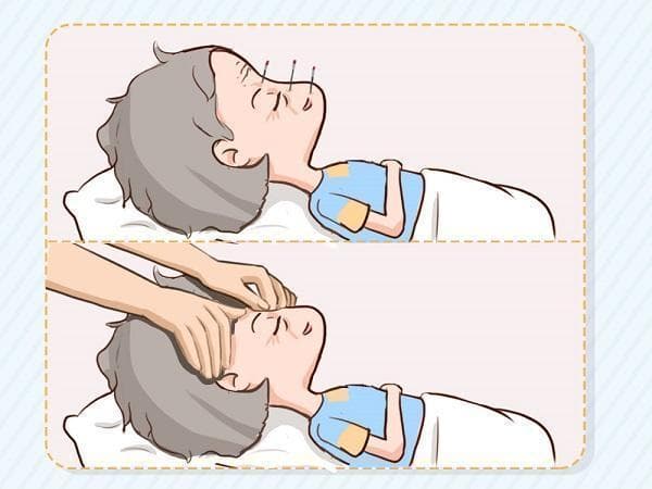 三叉神经痛让人痛不欲生，中药、针灸、推拿能治疗吗？