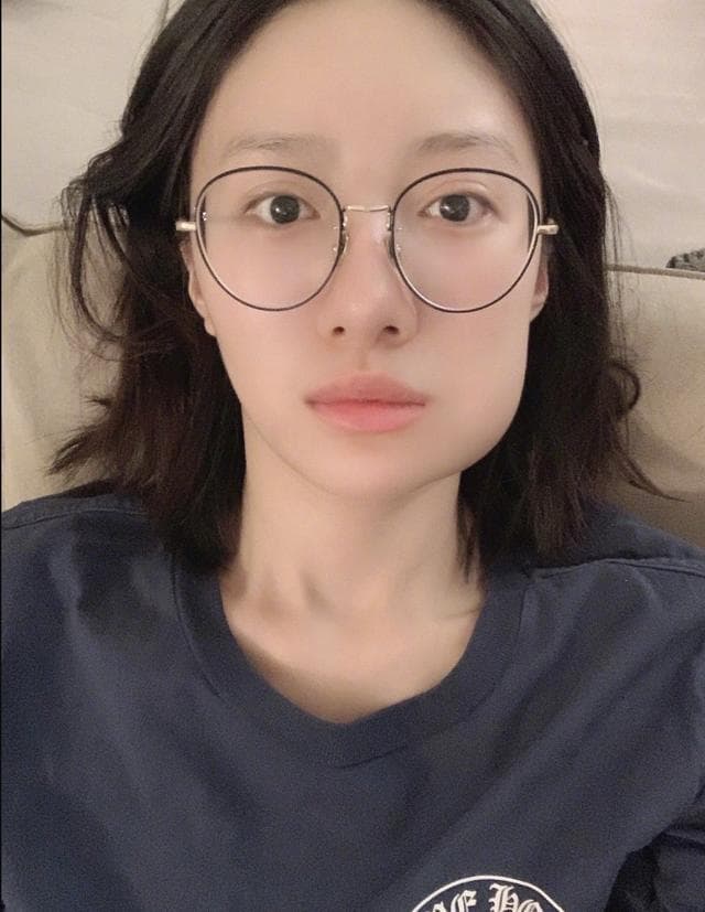 周冬雨拔智齿后脸部肿胀如馒头，网友：这是一场大型比丑现场