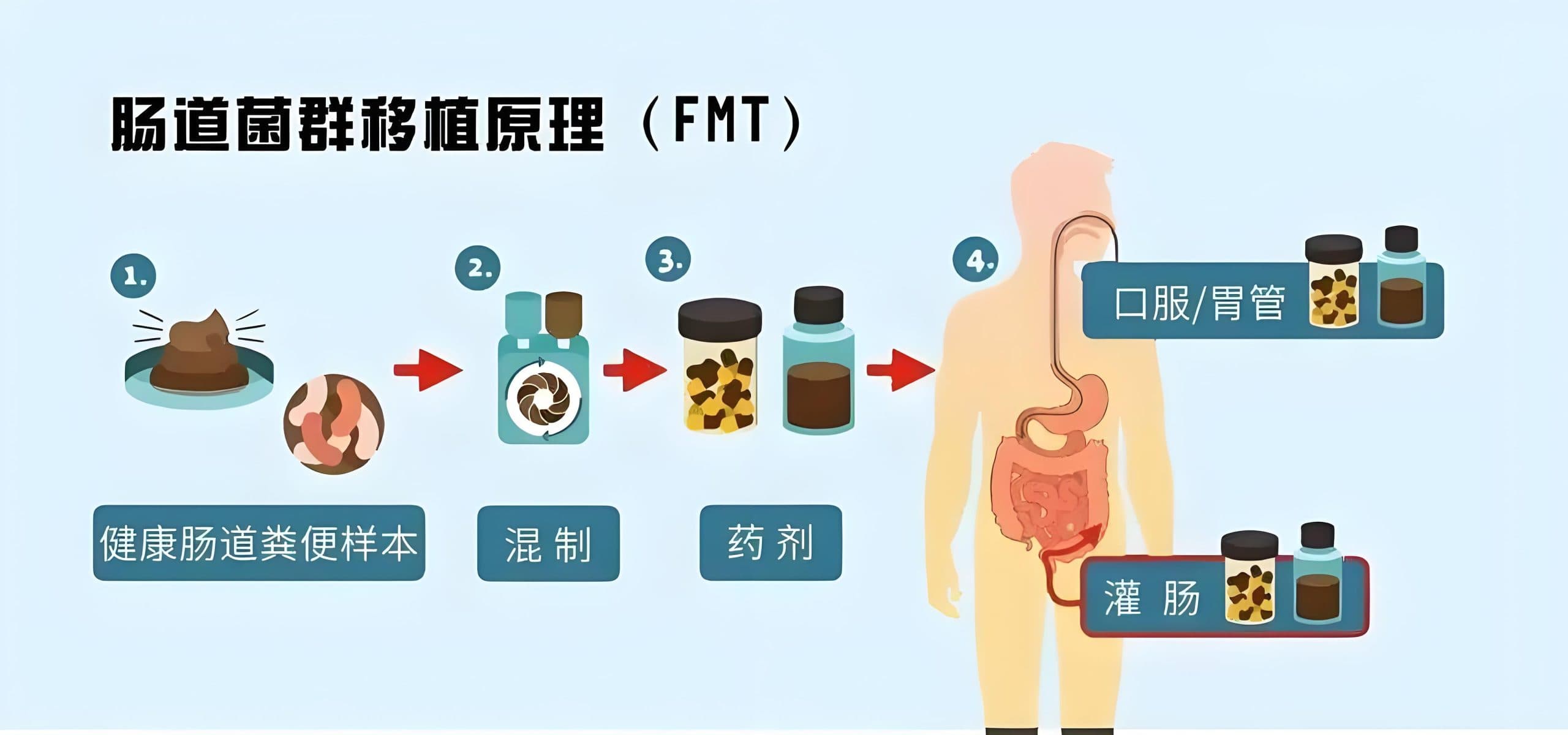 关于肠道菌群移植，你想知道的全在这里！