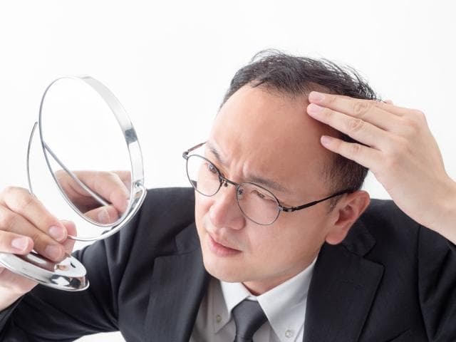 什么是植发？ 介绍人造头发和天然头发的区别以及头发移植的优缺点。